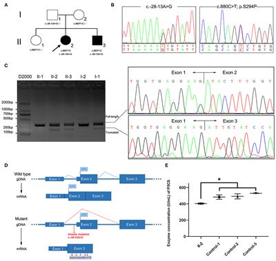 Novel Compound Missense and Intronic Splicing Mutation in ALDH18A1 Causes Autosomal Recessive Spastic Paraplegia